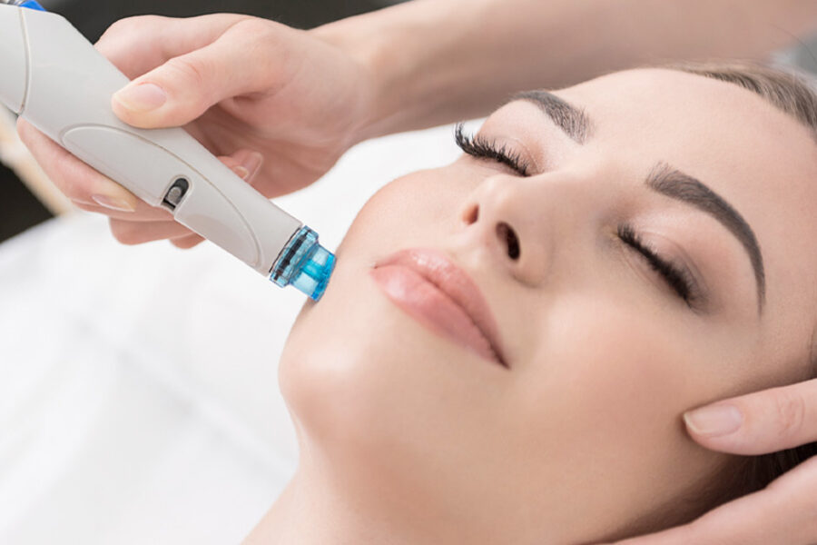 El Hydrafacial y sus grandes beneficios